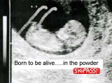 Echographie foetus