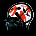 cerveau