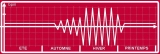 &eacute;lectrocardiogramme