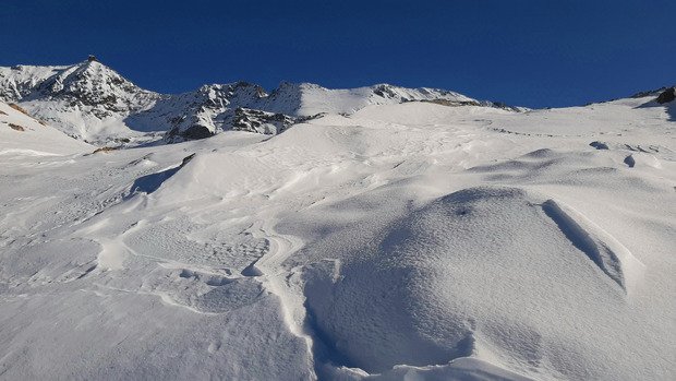 Ça se prépare, 40 au Dôme 