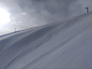 Bracage partag&eacute;