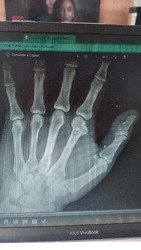 La journ&eacute;e de l' ann&eacute;e ,m&eacute;morable !