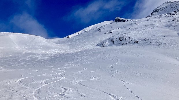 Compliqu&eacute; aujourd&rsquo;hui 🫩