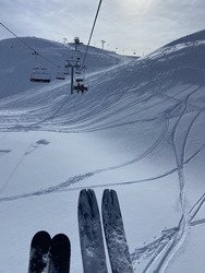 Du soleil et des bosses