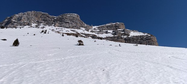 Ma premi&egrave;re Dent... &agrave; 45 ans ! 🤔😜