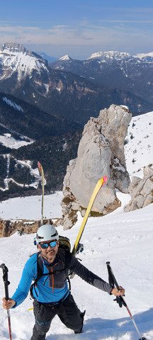 Ma premi&egrave;re Dent... &agrave; 45 ans ! 🤔😜