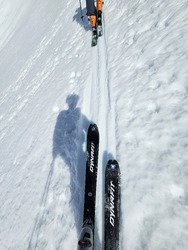 Th&egrave;me du jour : les ampoules aux talons
