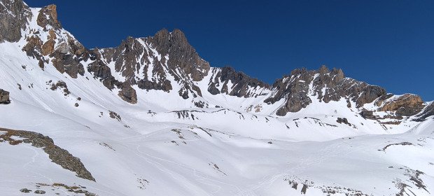 Et voil&agrave; ma deuxi&egrave;me dent 😂