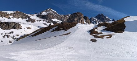 Et voil&agrave; ma deuxi&egrave;me dent 😂