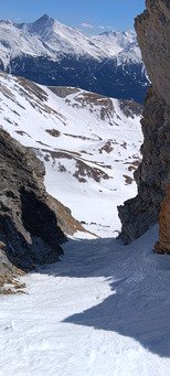 Et voil&agrave; ma deuxi&egrave;me dent 😂