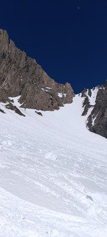 Et voil&agrave; ma deuxi&egrave;me dent 😂