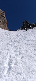 Et voil&agrave; ma deuxi&egrave;me dent 😂