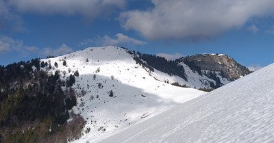 Ma premi&egrave;re Dent... &agrave; 45 ans ! 🤔😜