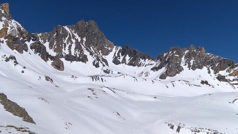 Et voil&agrave; ma deuxi&egrave;me dent 😂